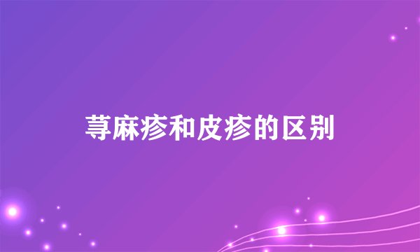 荨麻疹和皮疹的区别