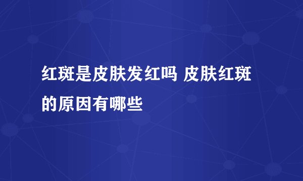 红斑是皮肤发红吗 皮肤红斑的原因有哪些
