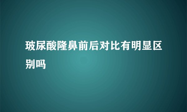 玻尿酸隆鼻前后对比有明显区别吗