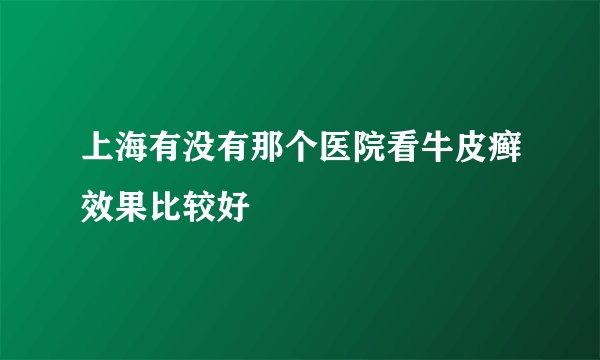 上海有没有那个医院看牛皮癣效果比较好
