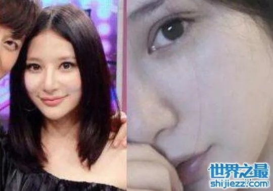 熊乃瑾整容前后照片对比,清新女神整容失败香肠嘴