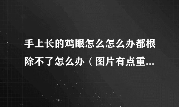 手上长的鸡眼怎么怎么办都根除不了怎么办（图片有点重口，，）？