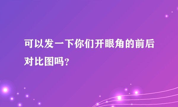 可以发一下你们开眼角的前后对比图吗？