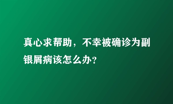 真心求帮助，不幸被确诊为副银屑病该怎么办？