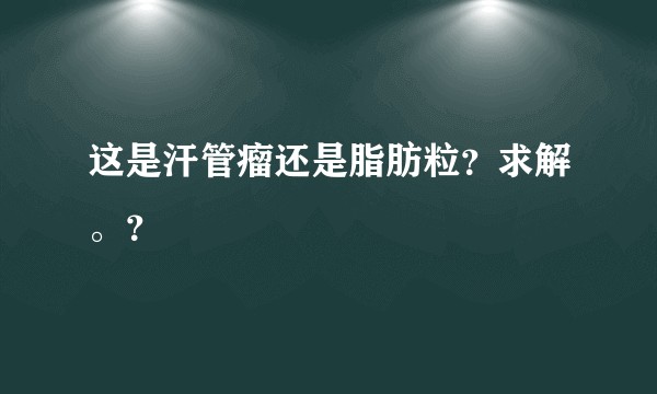 这是汗管瘤还是脂肪粒？求解。？