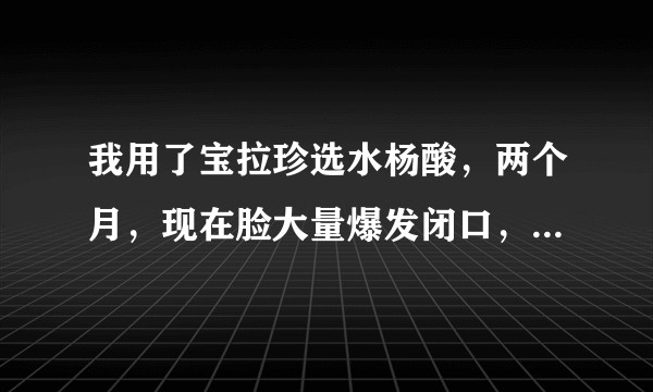 我用了宝拉珍选水杨酸,两个月,现在脸大量爆发闭口,去皮肤病医院针清闭口,恢复慢,请问去闭口的方法?
